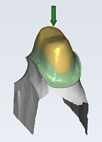 exaple crown bottoms gap