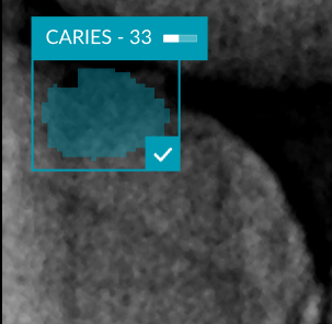 focus area hover