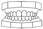 occlusion fixed