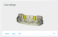 case design tempshell