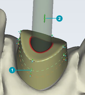 example abutment design