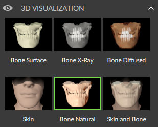 3D visualization