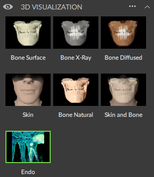 3D visualization