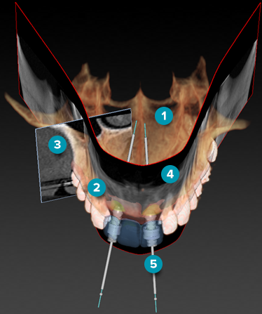 Planning objects with numbers.png